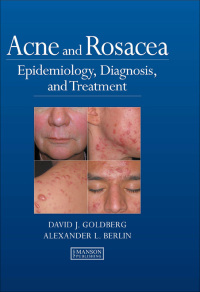 Omslagafbeelding: Acne and Rosacea 1st edition 9780367452216