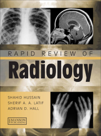 Omslagafbeelding: Rapid Review of Radiology 1st edition 9781840761207