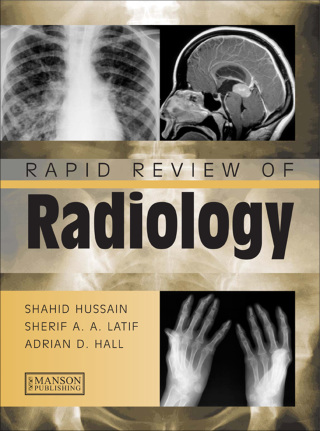 Immagine di copertina: Rapid Review of Radiology 1st edition 9781840761207