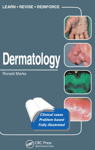 Cover image: Dermatology 1st edition 9781840761665