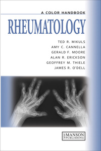 Cover image: Rheumatology 1st edition 9780815396574