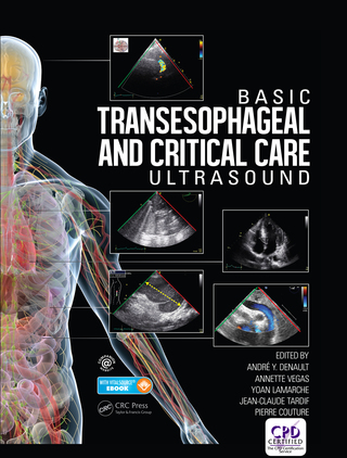 Cover image: Basic Transesophageal and Critical Care Ultrasound 1st edition 9781482237122