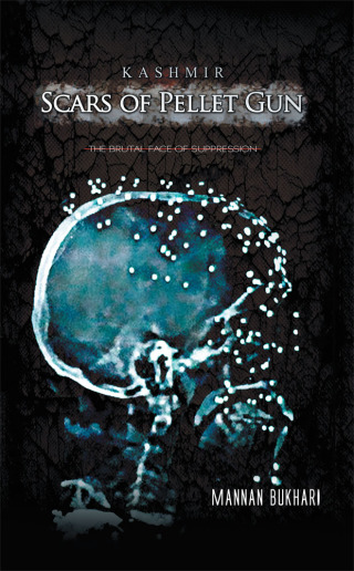 Cover image: Kashmir - Scars of Pellet Gun 9781482850079
