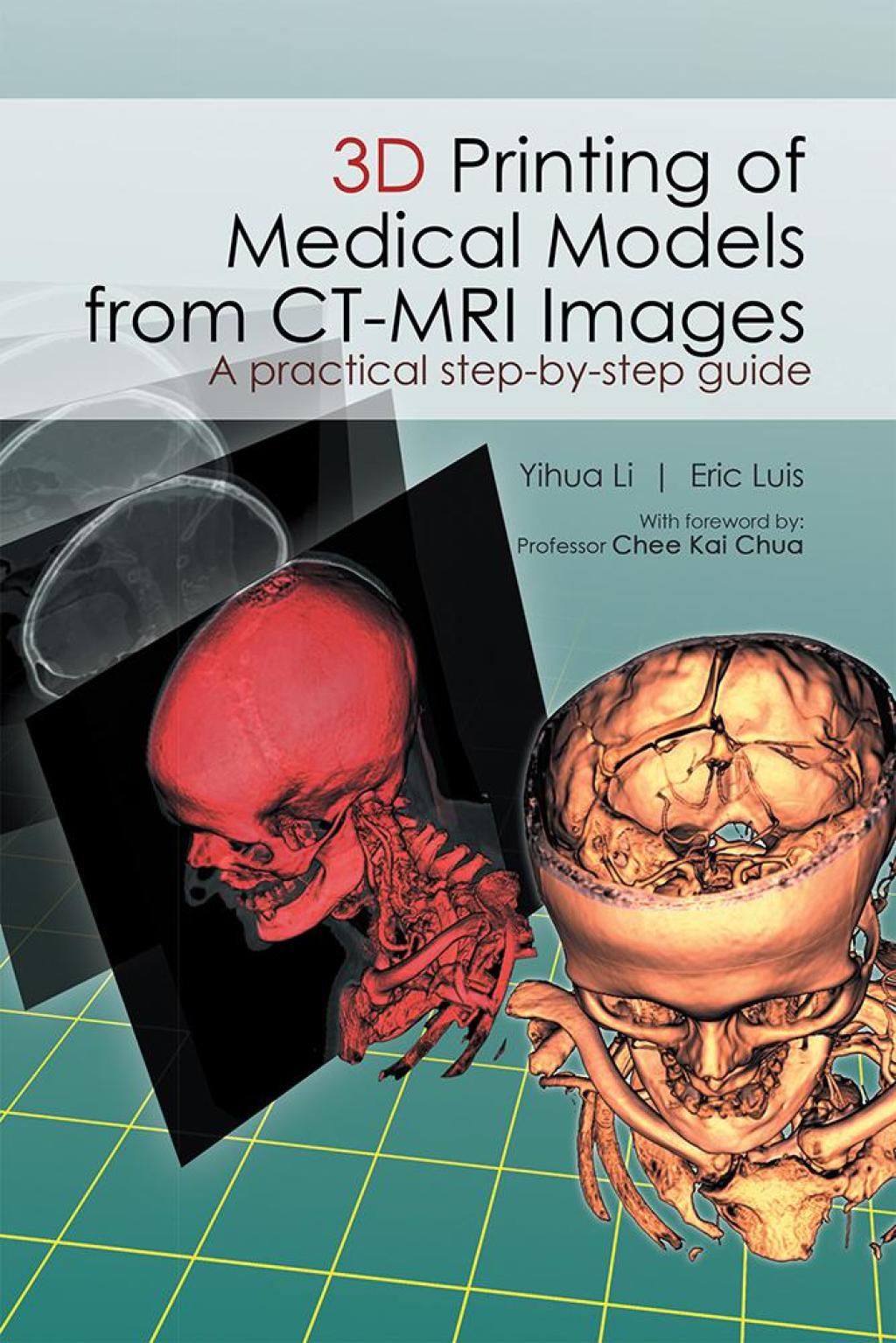 3D Printing of Medical Models  from Ct-Mri Images A Practical Step-By-Step Guide