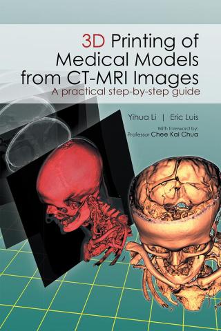 Titelbild: 3D Printing of Medical Models  from Ct-Mri Images 9781482879407