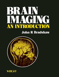 Cover image: Brain Imaging 9780723605966