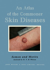 Imagen de portada: An Atlas of the Commoner Skin Diseases 5th edition 9781483229515