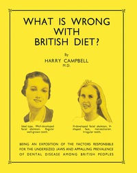 Immagine di copertina: What Is Wrong with British Diet? 9781483227641