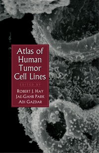 صورة الغلاف: Atlas of Human Tumor Cell Lines 9780123335302