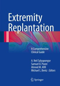 Cover image: Extremity Replantation 9781489975157