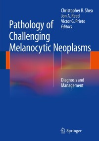Imagen de portada: Pathology of Challenging Melanocytic Neoplasms 9781493914432