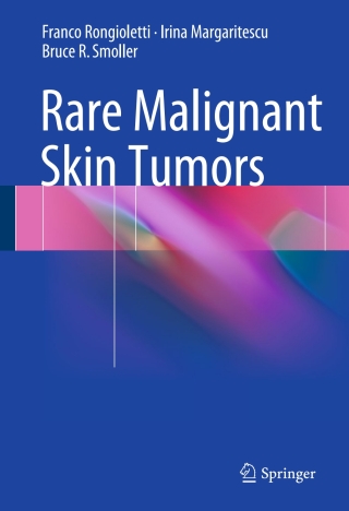 Omslagafbeelding: Rare Malignant Skin Tumors 9781493920228