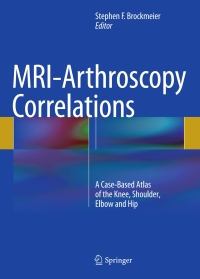 Cover image: MRI-Arthroscopy Correlations 9781493926442