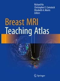 Cover image: Breast MRI Teaching Atlas 9781493964079