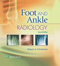 صورة الغلاف: Foot and Ankle Radiology 2nd edition 9781451192834