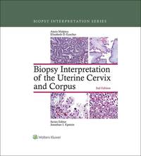 Cover image: Biopsy Interpretation of the Uterine Cervix and Corpus 2nd edition 9781451192964