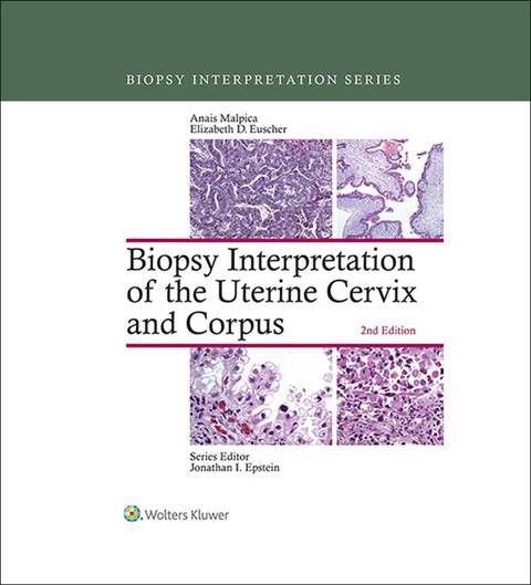 Biopsy Interpretation of the Uterine Cervix and Corpus, 2nd Edition - FULL INSTANT DOWNLOAD | PDF DOCX EPUB