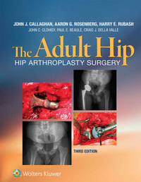 Cover image: The Adult Hip 3rd edition 9781451183696