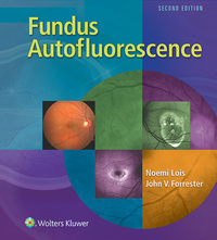 Cover image: Fundus Autofluorescence 2nd edition 9781451194593