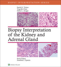 表紙画像: Biopsy Interpretation of the Kidney & Adrenal Gland 9781451176476