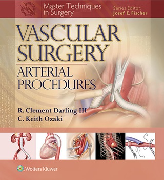 Cover image: Master Techniques in Surgery: Vascular Surgery: Arterial Procedures 9781451191615
