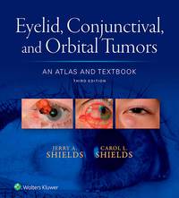 Titelbild: Eyelid, Conjunctival, and Orbital Tumors: An Atlas and Textbook 3rd edition 9781496321480