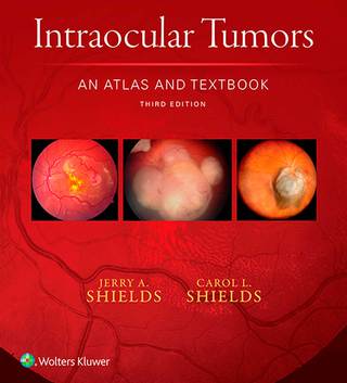 Imagen de portada: Intraocular Tumors: An Atlas and Textbook 3rd edition 9781496321343