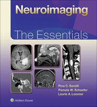 Cover image: Neuroimaging: The Essentials 9781451191356