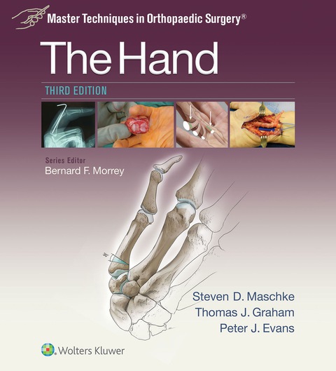 Master Techniques in Orthopaedic Surgery: The Hand, 3rd Edition - FULL INSTANT DOWNLOAD | PDF DOCX EPUB