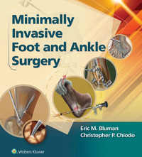 表紙画像: Minimally Invasive Foot & Ankle Surgery 9781451131611