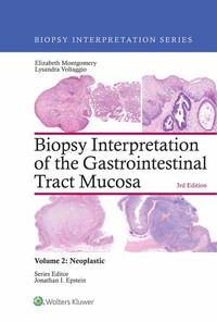 Omslagafbeelding: Biopsy Interpretation of the Gastrointestinal Tract Mucosa: Volume 2: Neoplastic 3rd edition 9781496337313