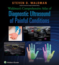 表紙画像: Waldman's Comprehensive Atlas of Diagnostic Ultrasound of Painful Conditions 1st edition 9781496302892