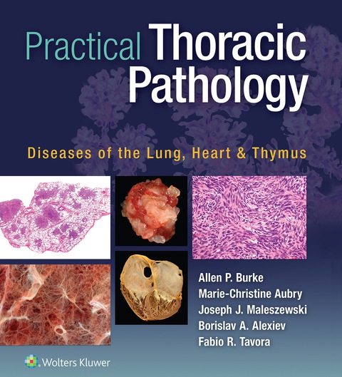 Practical Thoracic Pathology: Diseases of the Lung, Heart, and Thymus - FULL INSTANT DOWNLOAD | PDF DOCX EPUB