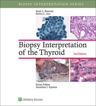 Cover image: Biopsy Interpretation of the Thyroid 2nd edition 9781496355850