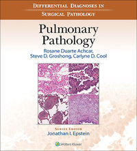 صورة الغلاف: Differential Diagnosis in Surgical Pathology: Pulmonary Pathology 9781451195279