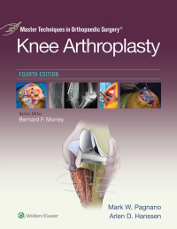 Imagen de portada: Master Techniques in Orthopedic Surgery: Knee Arthroplasty 9781496315052
