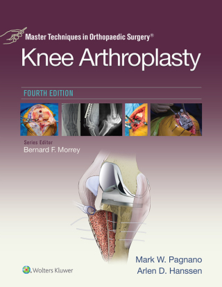 Cover image: Master Techniques in Orthopedic Surgery: Knee Arthroplasty 9781496315052
