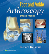 Cover image: Foot & Ankle Arthroscopy 2nd edition 9780781783415