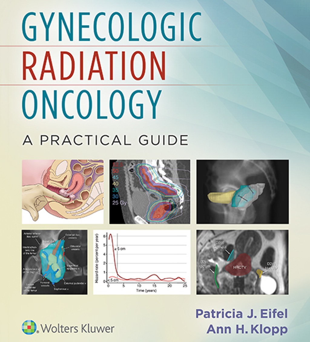 Gynecologic Radiation Oncology: A Practical Guide