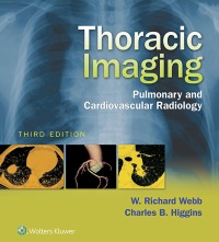 Titelbild: Thoracic Imaging 3rd edition 9781496321046