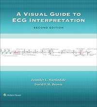 Cover image: A Visual Guide to ECG Interpretation 2nd edition 9781496321534