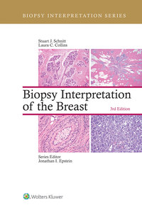 Cover image: Biopsy Interpretation of the Breast 3rd edition 9781496365750
