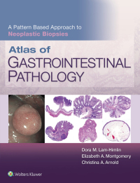 Omslagafbeelding: Atlas of Gastrointestinal Pathology: A Pattern Based Approach to Neoplastic Biopsies 9781496367549