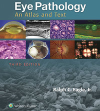 Omslagafbeelding: Eye Pathology 3rd edition 9781496337177