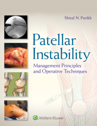 Cover image: Patellar Instability 9781496380821