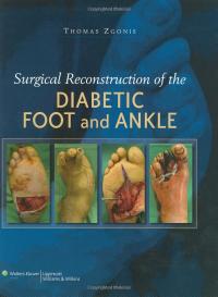 表紙画像: Surgical Reconstruction of the Diabetic Foot and Ankle 1st edition 9780781784580