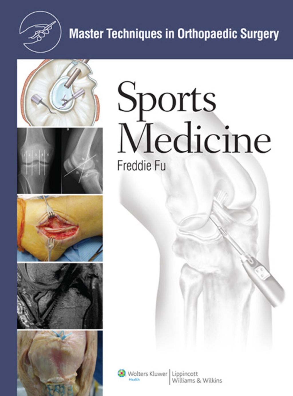 Master Techniques in Orthopaedic Surgery: Sports Medicine 1st Edition