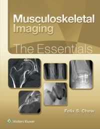 Imagen de portada: Musculoskeletal Imaging: The Essentials 9781496383839