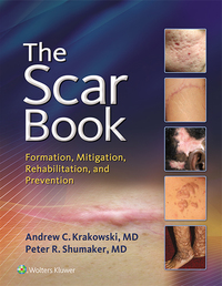 Cover image: The Scar Book 9781496322388