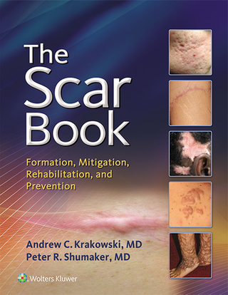 Imagen de portada: The Scar Book 9781496322388